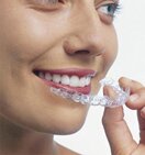Съемные каппы Invisalign